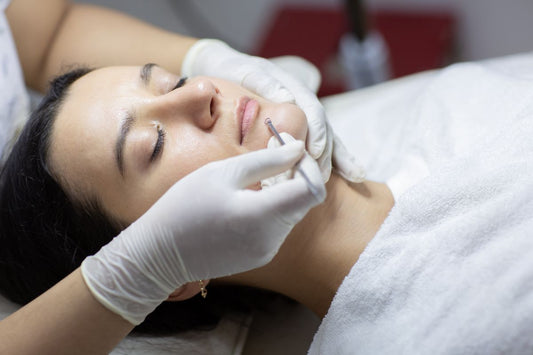 Acne Extraction Methods and Treatments