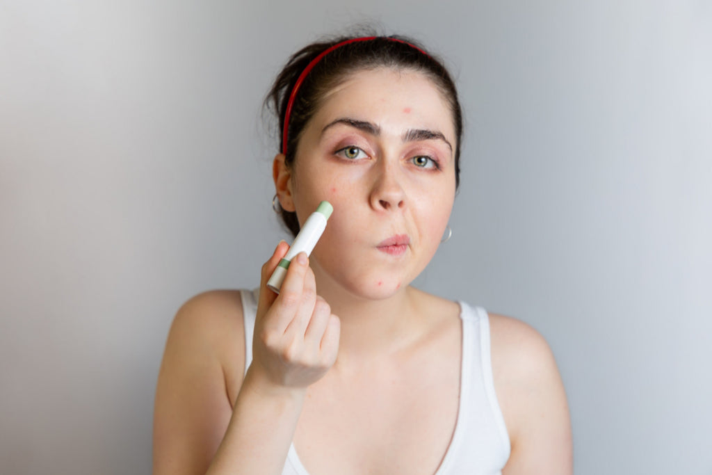 how to cover up a pimple with makeup