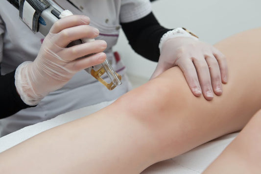 laser hair removal