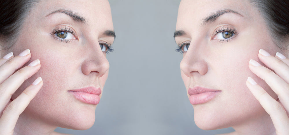 How to Treat Textured Skin?