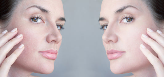 How to Treat Textured Skin?
