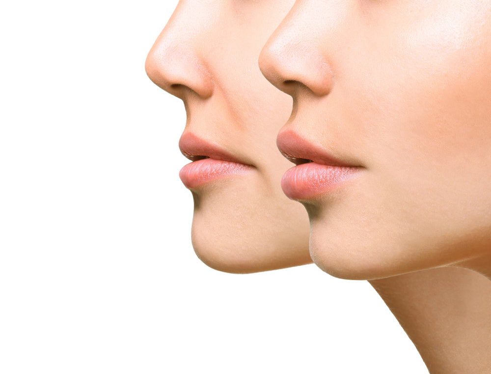 Transform Your Skin with Sculptra: The Ultimate Guide