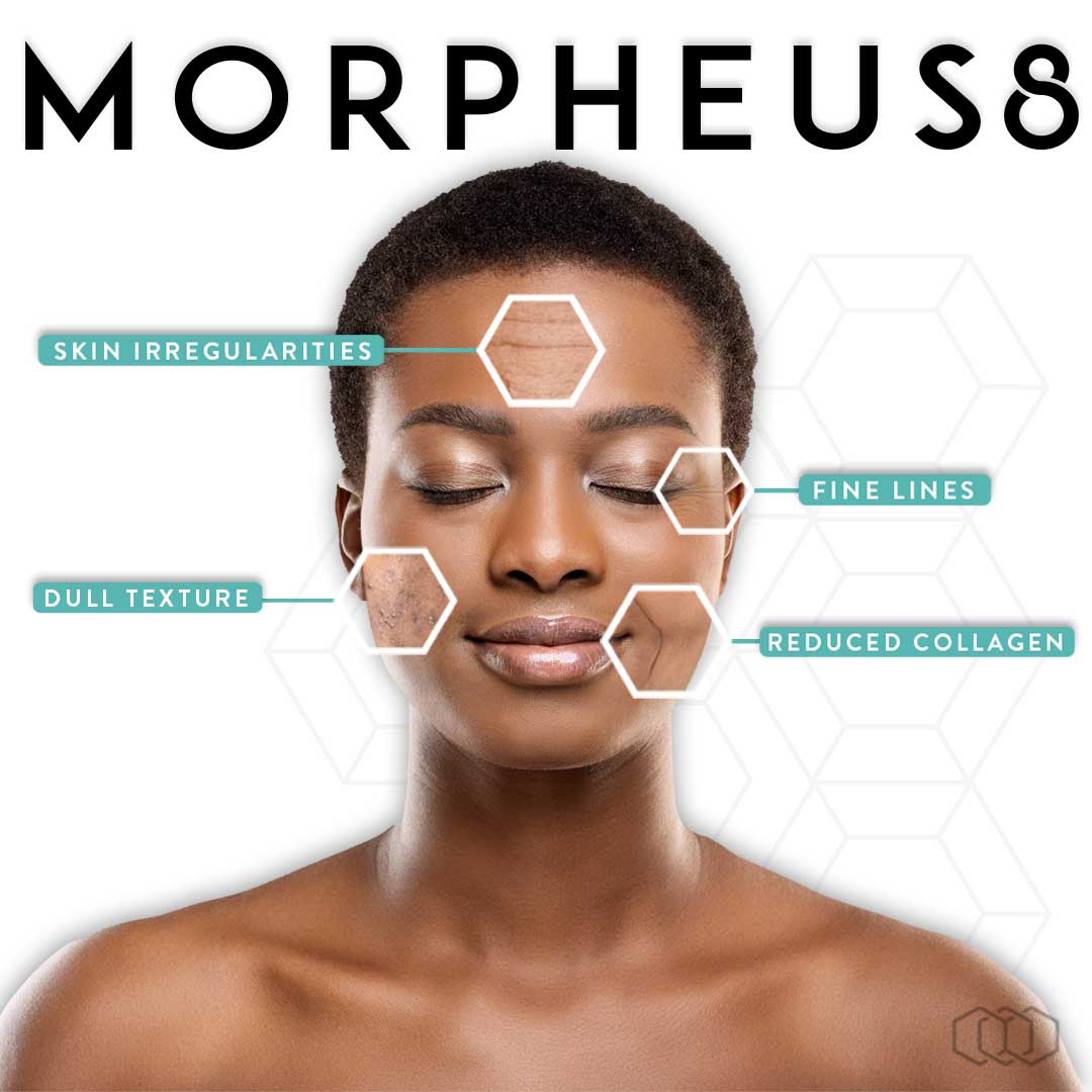 Morpheus8 @ Skin Spa New York