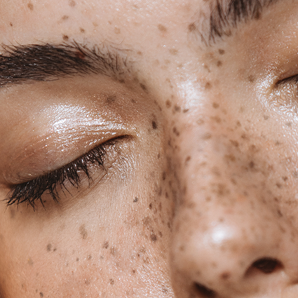 In the Spotlight Facial @ Skin Spa New York