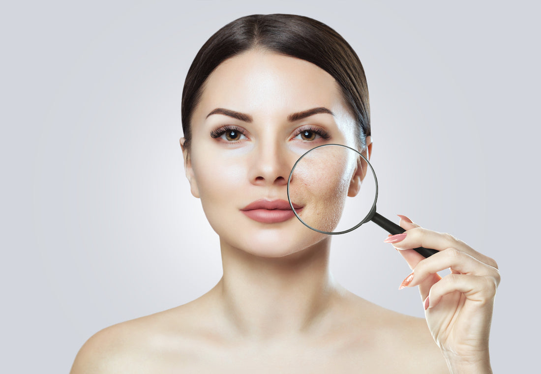 Dermaplaning side effects: woman with a magnifying glass up close on her skin