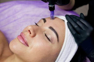 How Often Should I Get Microneedling Treatments?