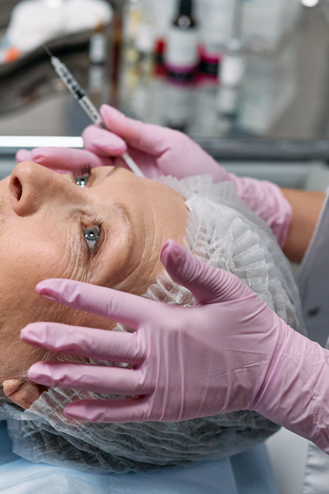 How Long Does Botox Last? A Comprehensive Guide