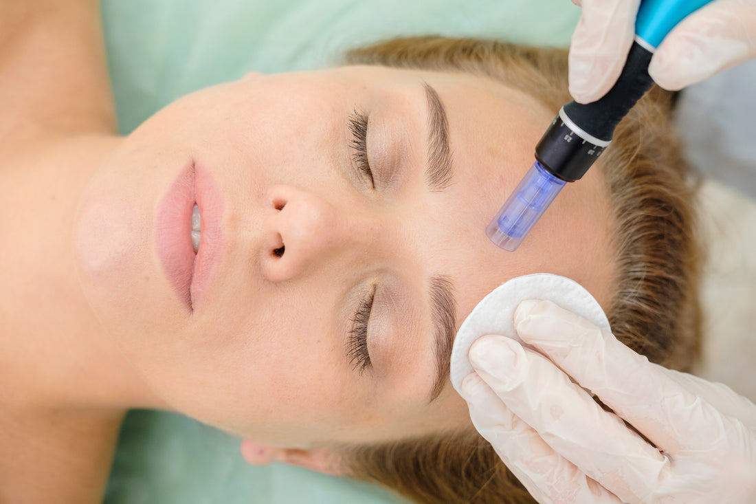 Which Skin Problems Does Microneedling Tackle Best?