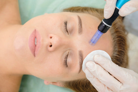 Which Skin Problems Does Microneedling Tackle Best?