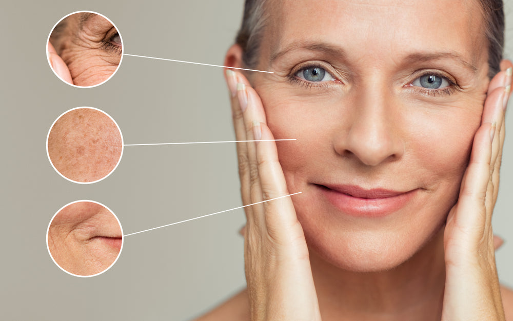 The Best Treatment for Deep Wrinkles on Face