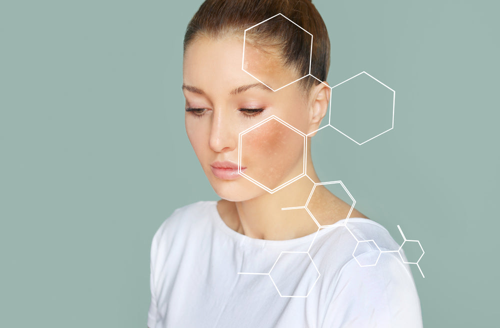 How to Get Rid of Dark Spots on the Face