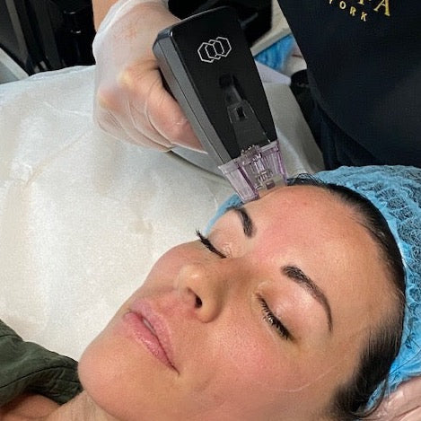 Morpheus8 @ Skin Spa New York
