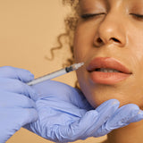 Cosmetic Fillers (Restylane, Juvederm, Radiesse)