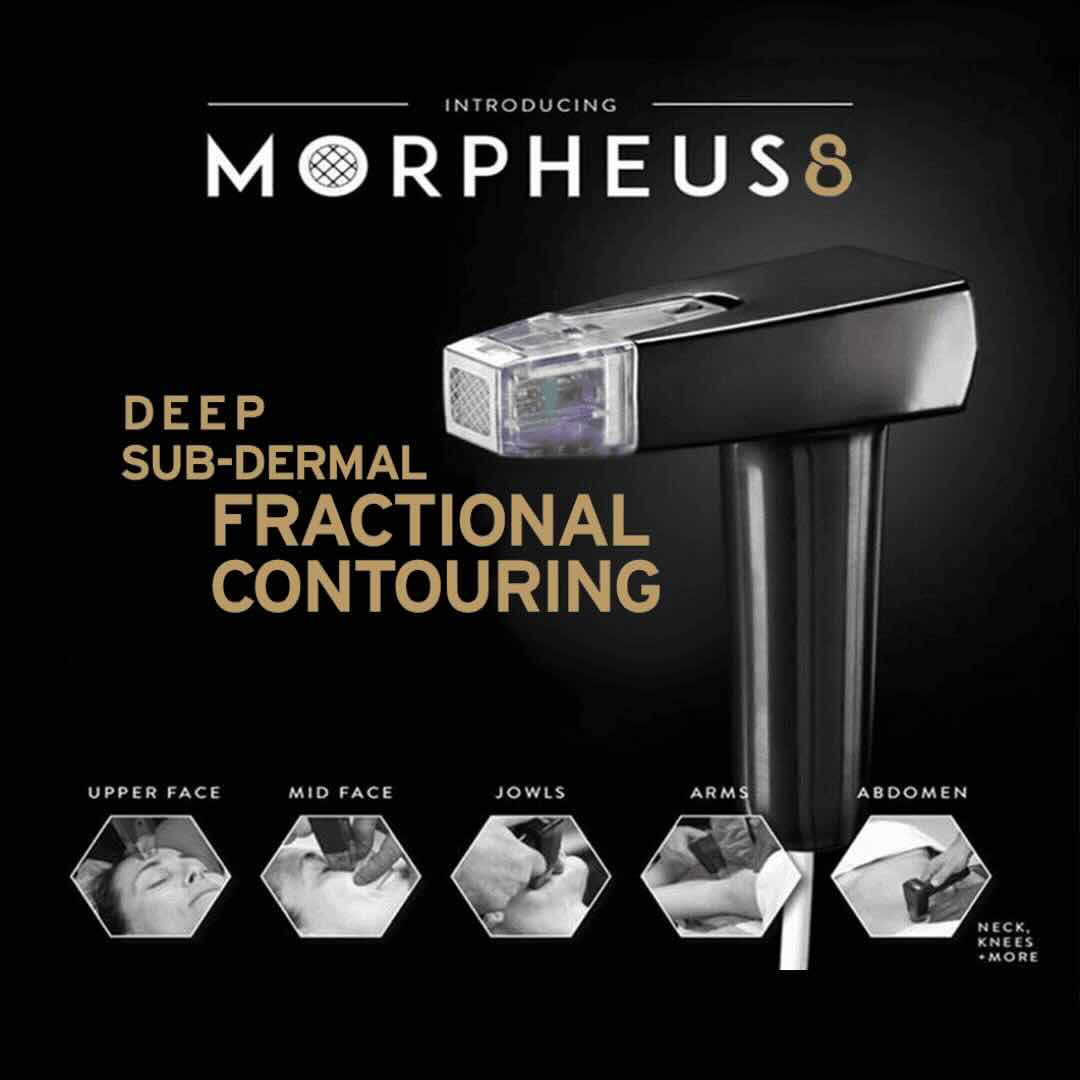 Morpheus8 Face Treatment