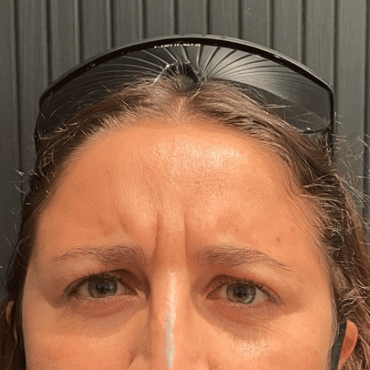 Cosmetic Injectables @ Skin Spa New York