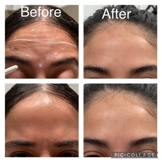 Cosmetic Injectables @ Skin Spa New York