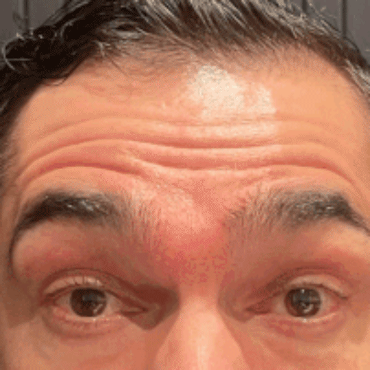 Cosmetic Injectables @ Skin Spa New York