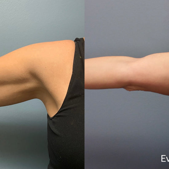 Evolve @ SKINSPANEWYORK