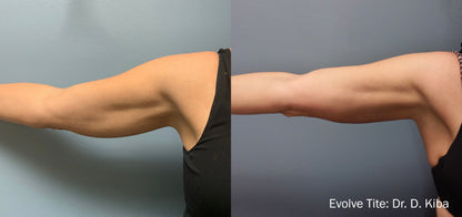 Evolve @ SKINSPANEWYORK