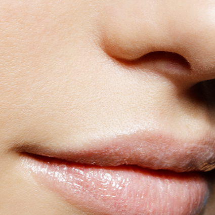 Laser Hair Removal