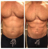 Before and After: Man undergoes Emsculpt body sculpting treatment. The results are more defined abs and weight loss around the stomach.