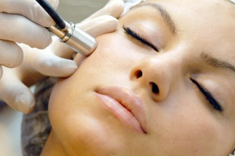 Microdermabrasion